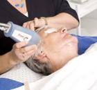 laser mole removal.jpg